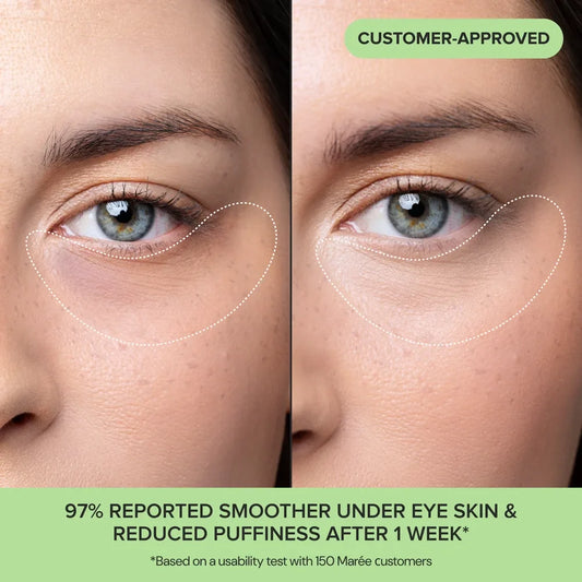 Before and after comparison of under-eye skin with text indicating customer-approved results.