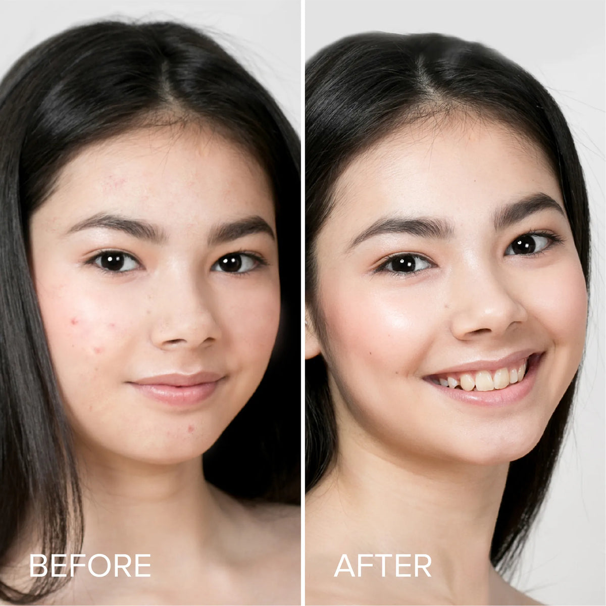 Before and after comparison of a woman's face with visible skin improvement.