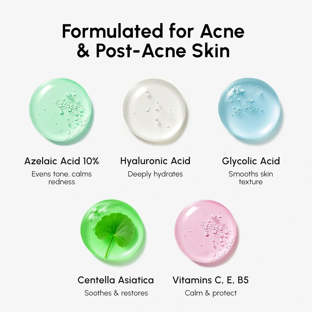 Skincare product formulations for acne and post-acne skin with labeled ingredients and benefits.