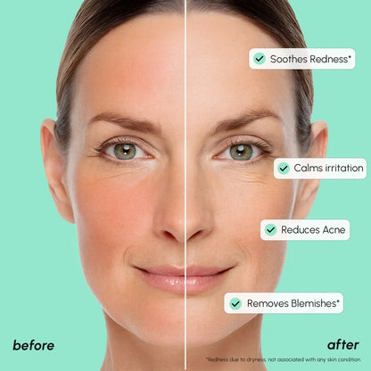 Before and after comparison of a woman's face with skin care benefits listed.