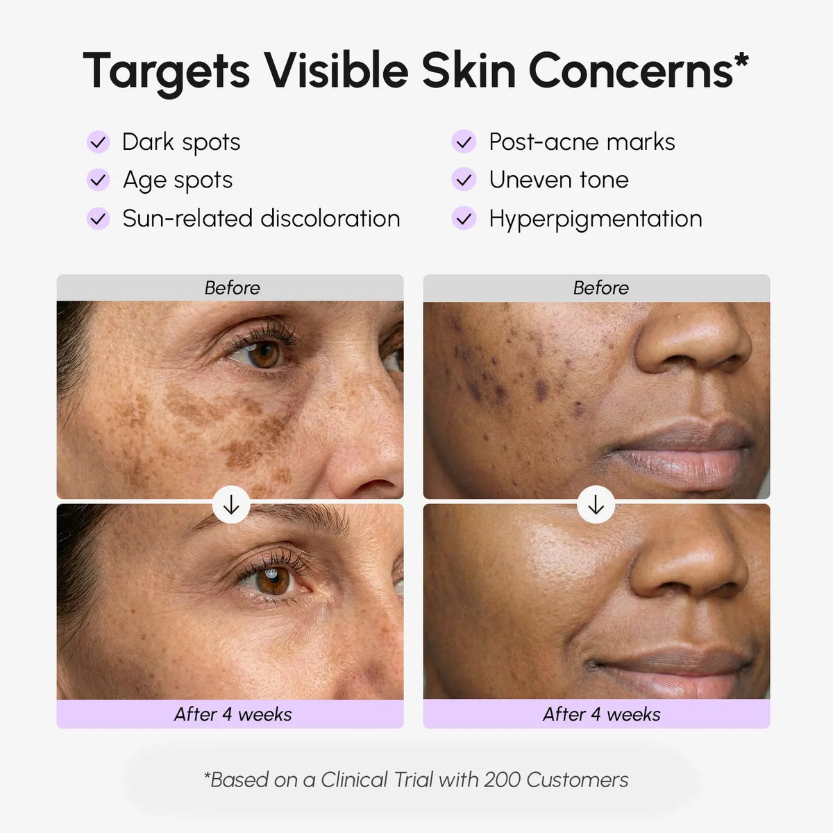 Before and after skin treatment results with visible improvements on a woman's face.