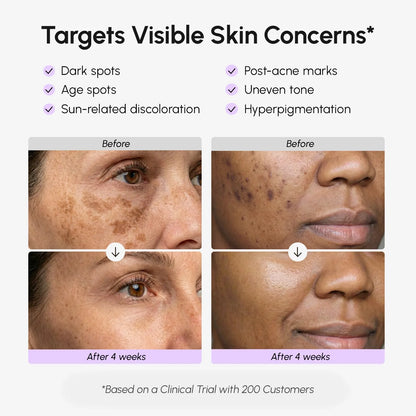 Before and after skin treatment results with visible improvements on a woman's face.