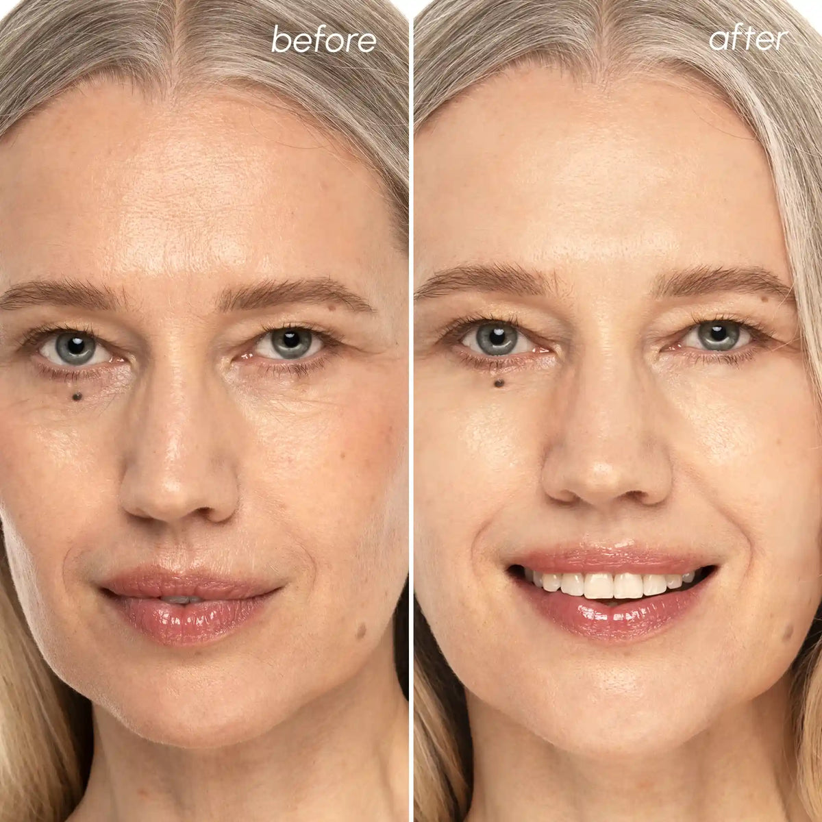 Before and after comparison of a woman's face with visible skin improvement.
