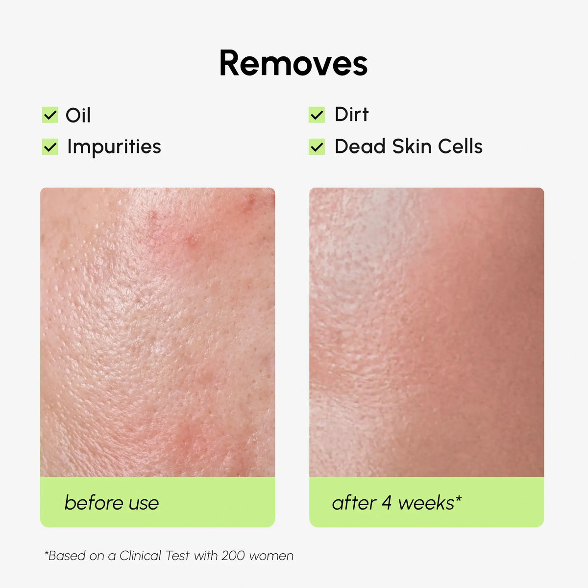 Before and after comparison of skin texture with text indicating what is removed by a product.