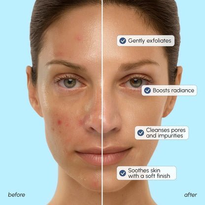 Before and after comparison of a woman's face with skin care benefits listed.