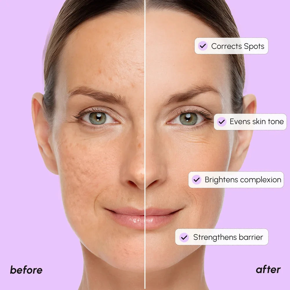 Before and after comparison of skin treatment on a purple background