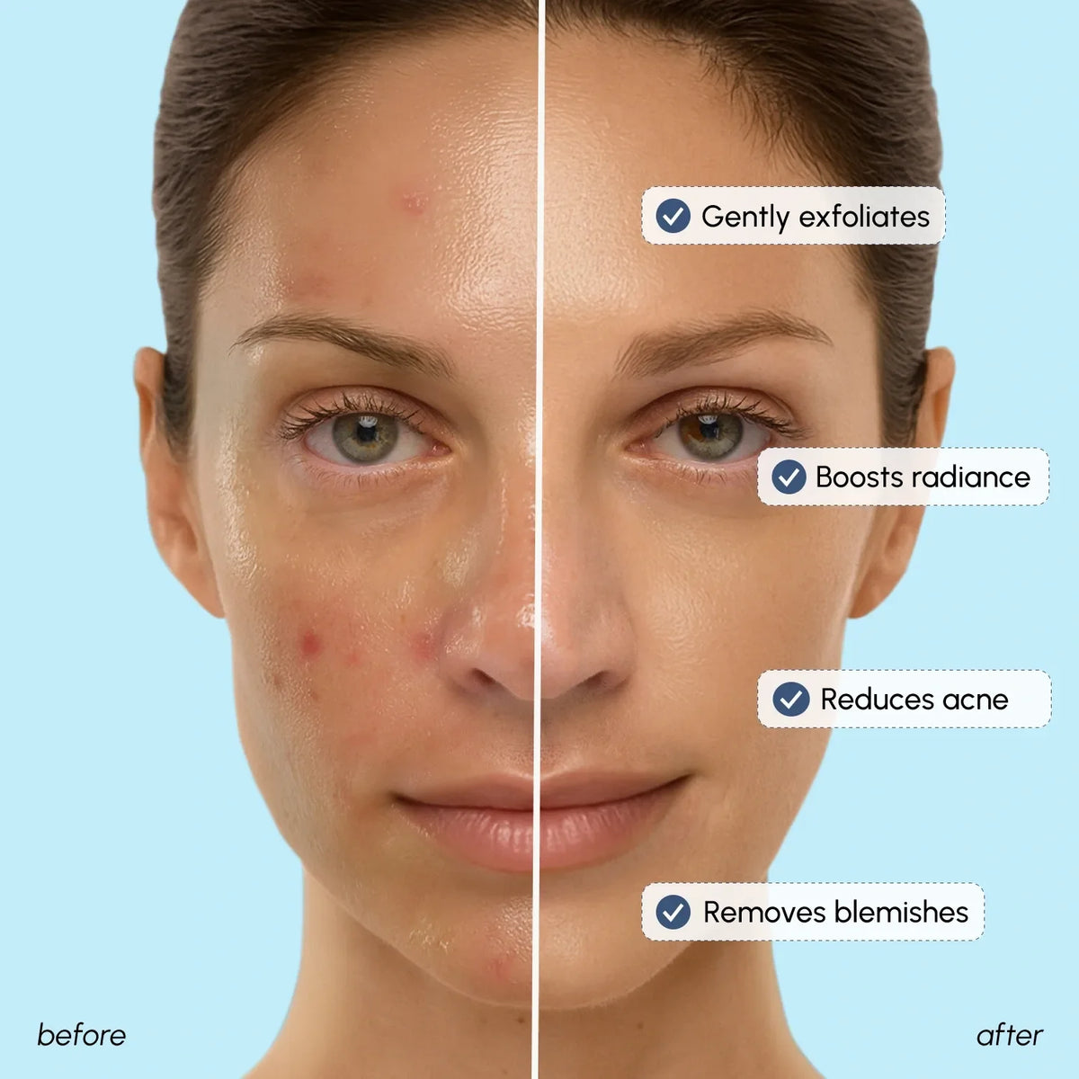 Before and after comparison of a woman's face with skin care benefits listed.