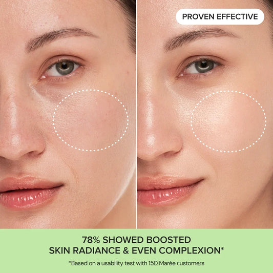 Before-and-after close-up of a woman's cheek and lower face showing a brighter, more even complexion, with dotted circles highlighting the treated area. Text reads 'PROVEN EFFECTIVE' and '78% SHOWED BOOSTED SKIN RADIANCE & EVEN COMPLEXION'.