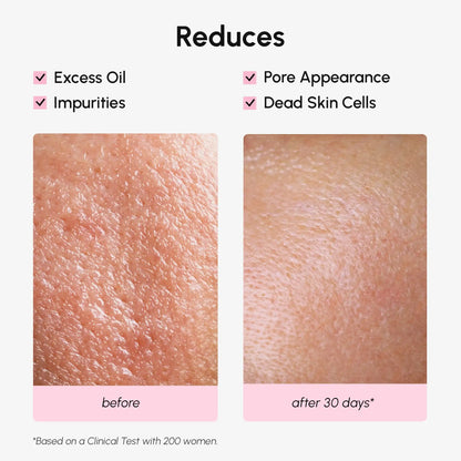 Before and after skin comparison showing reduced excess oil, pore appearance, and dead skin cells with a clinical test result.