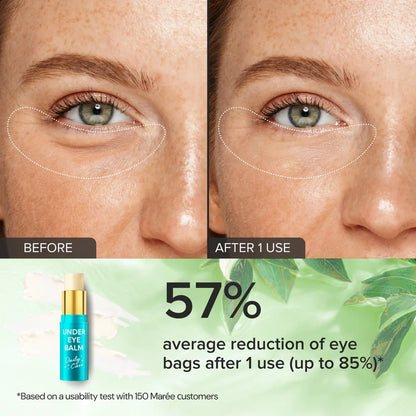 Before and after comparison of eye bags with a bottle of Under Eye Balm below.