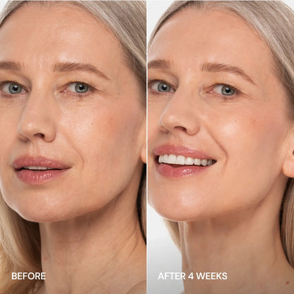 Before and after comparison of a woman's face with visible skin improvement over 4 weeks.