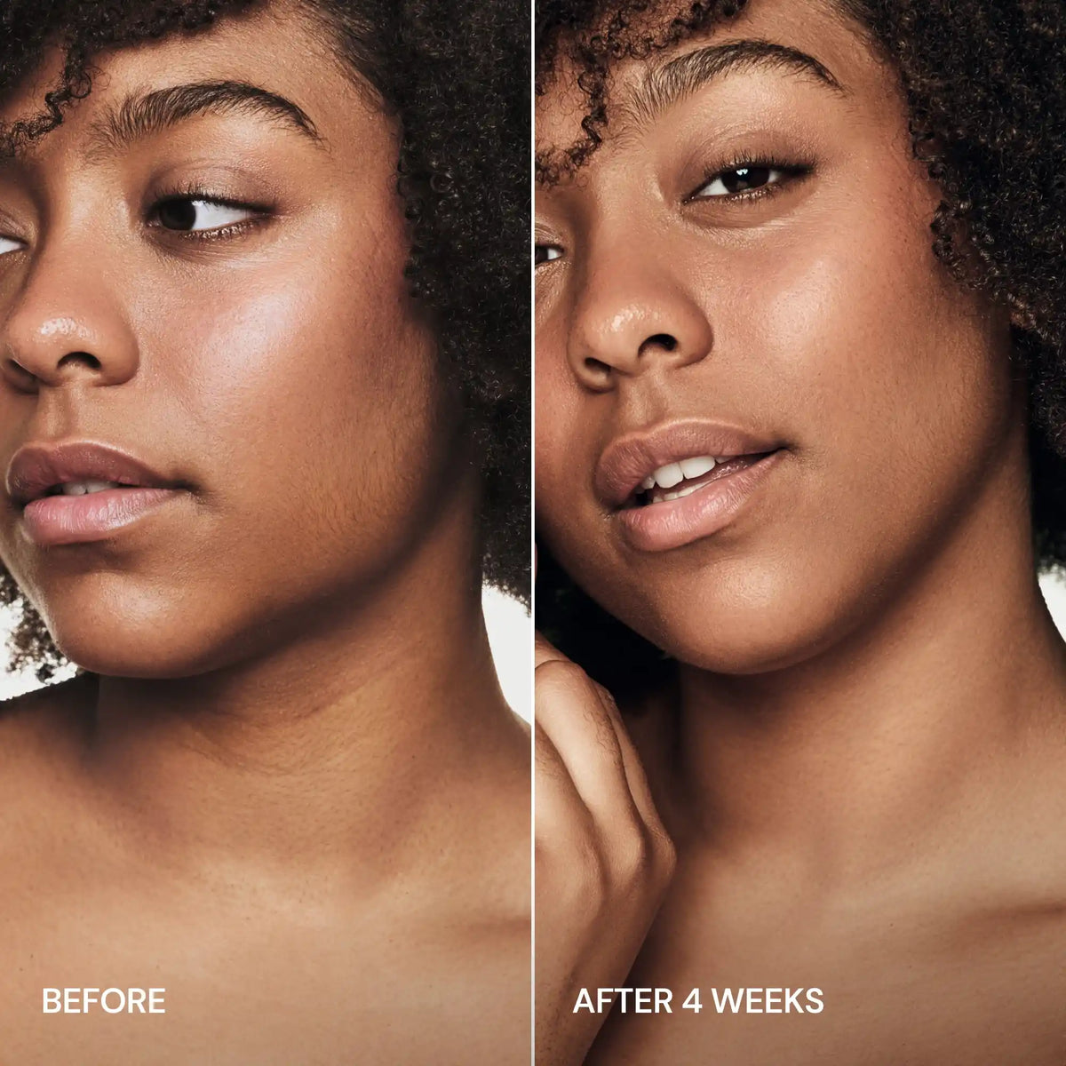 Before and after comparison of a woman's face with text indicating time elapsed.