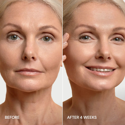 Before and after comparison of a woman's face with visible skin improvement after 4 weeks.
