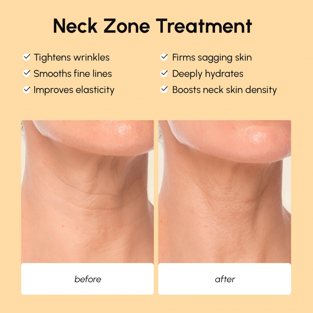 Neck zone treatment before and after showing tightened skin on a beige background.
