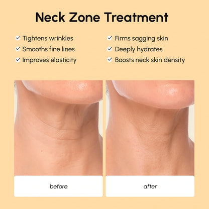 Neck zone treatment before and after showing tightened skin on a beige background.