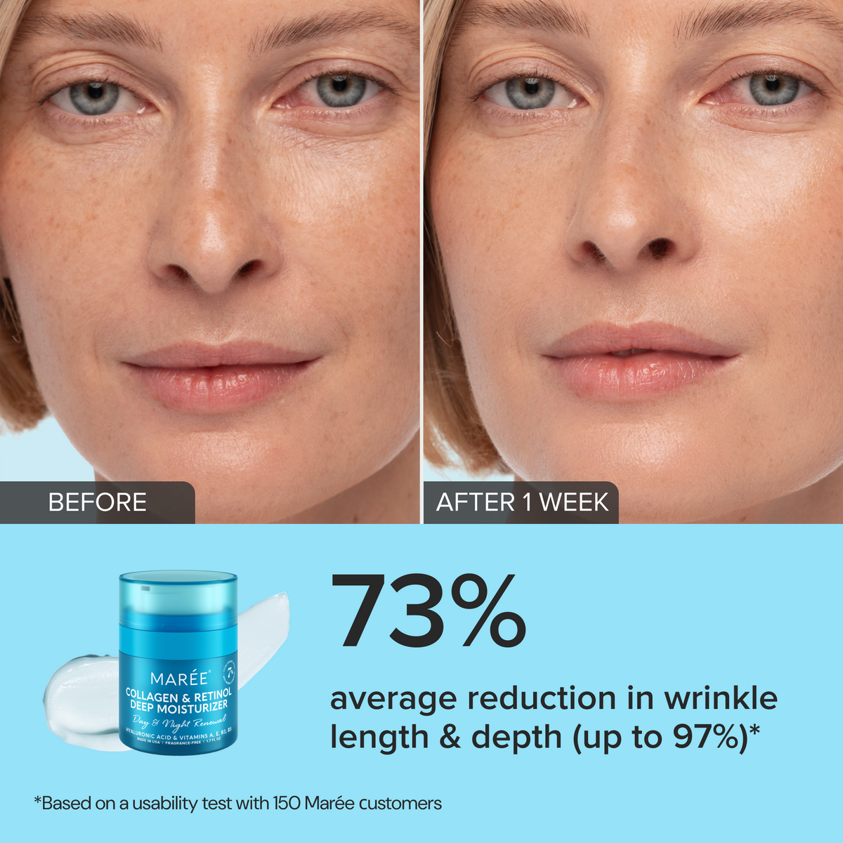 Before and after comparison of a woman's face with skincare product showing wrinkle reduction statistics.