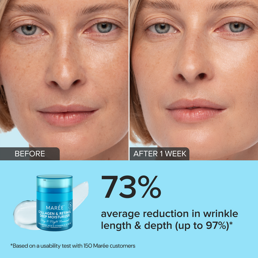 Before and after comparison of a woman's face with skincare product showing wrinkle reduction statistics.