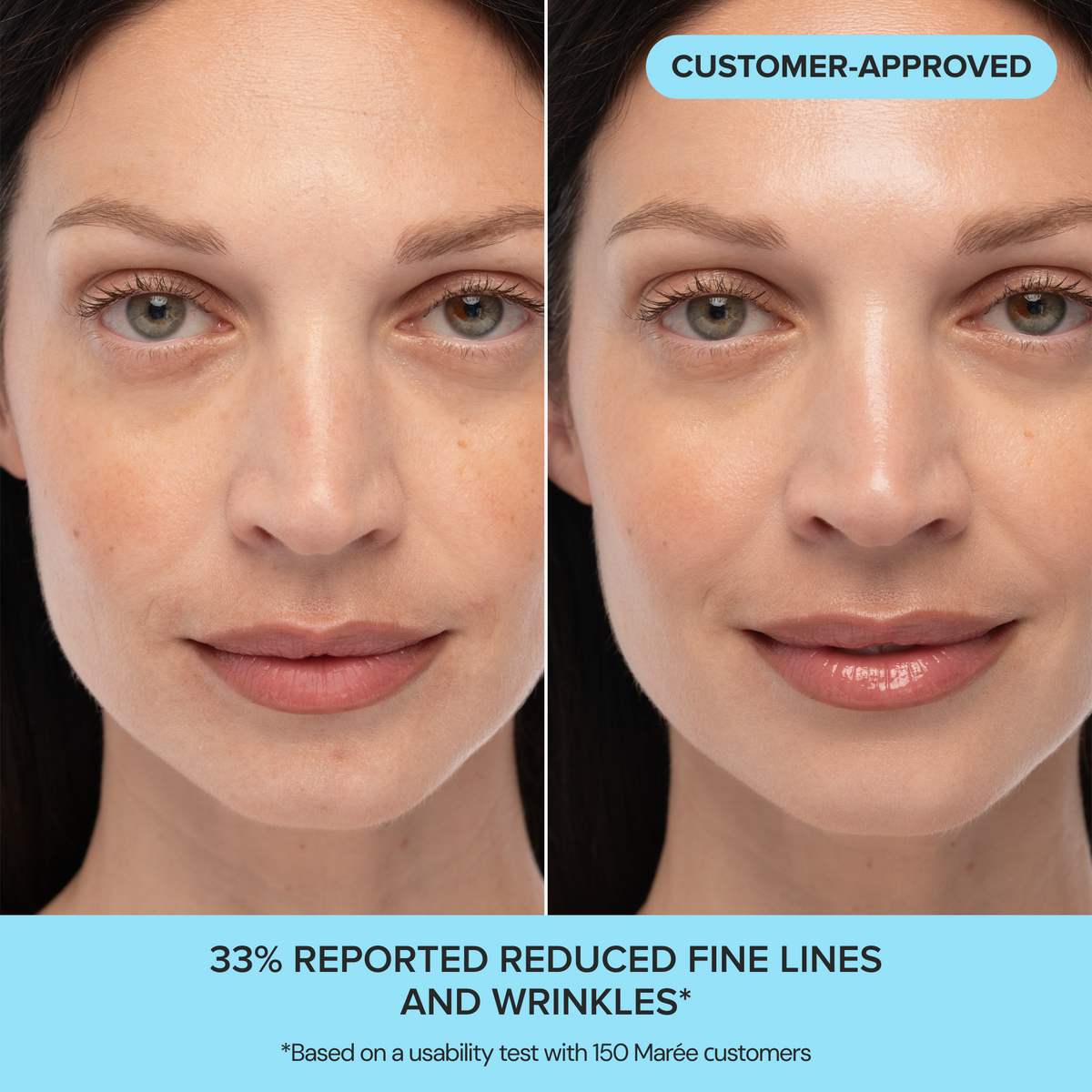 Before and after comparison of a woman's face with text indicating reduced fine lines and wrinkles.