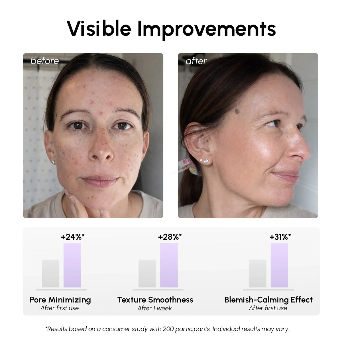 Before and after comparison of a woman's face with visible improvements in pore minimizing, texture smoothness, and blemish calming effect.