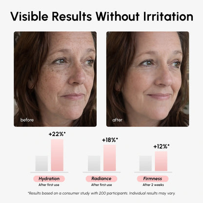 Before and after comparison of a woman's face with visible results without irritation, showing hydration, radiance, and firmness improvements.