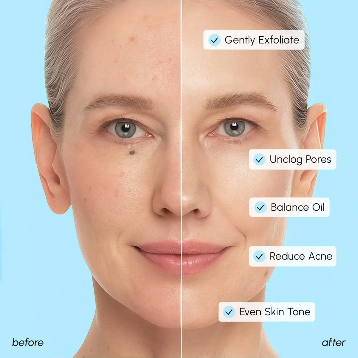 Before and after skin treatment comparison with text labels on a blue background