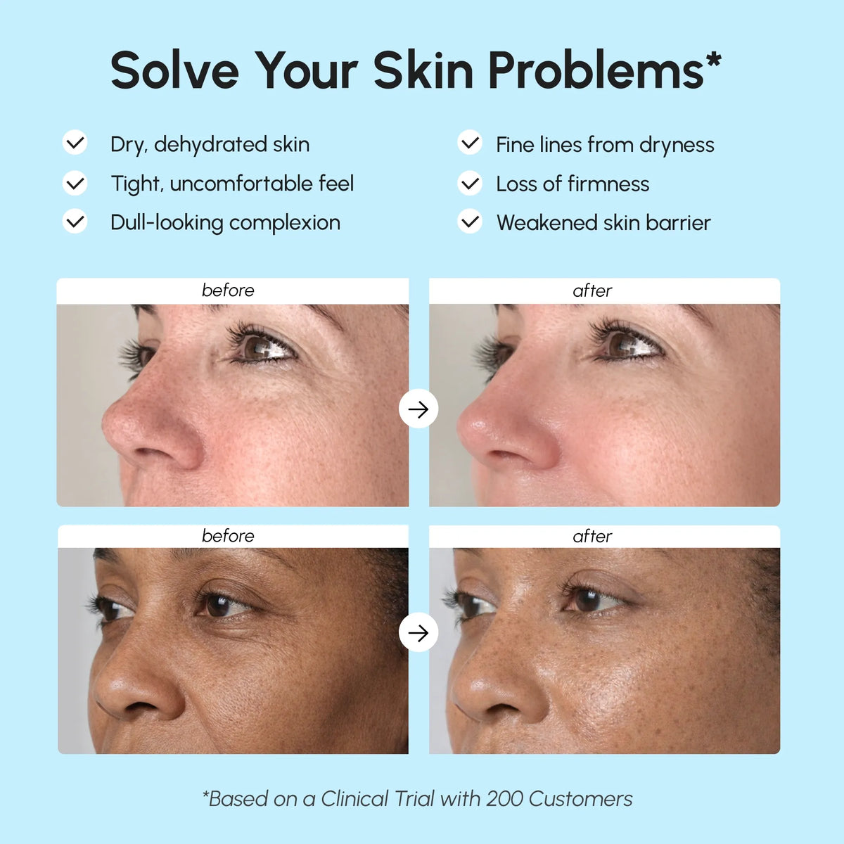 Before and after skin improvement results with text on a blue background