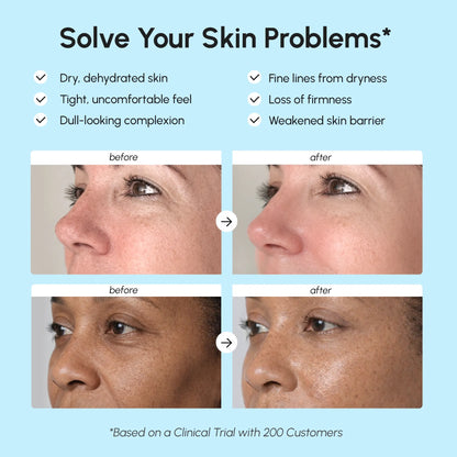 Before and after skin improvement results with text on a blue background