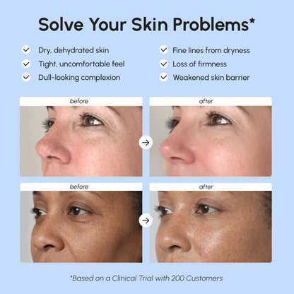 Before and after skin improvement results with text on a blue background