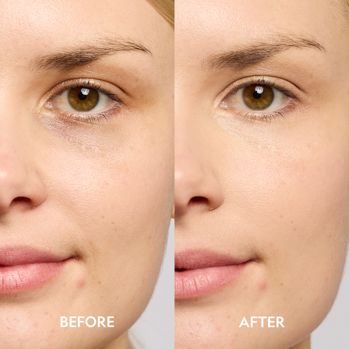Super Bright Dark Circle Serum Peptide Corrector in Light, before and after comparison