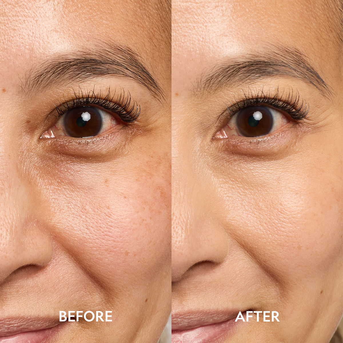 Super Bright Dark Circle Serum Peptide Corrector in Medium, before and after comparison