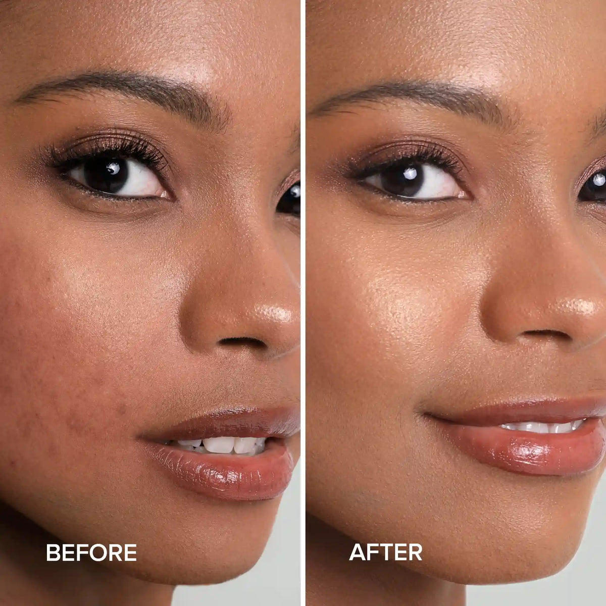 Before and after comparison of a woman's face with visible skin improvement.