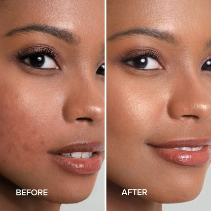 Before and after comparison of a woman's face with visible skin improvement.
